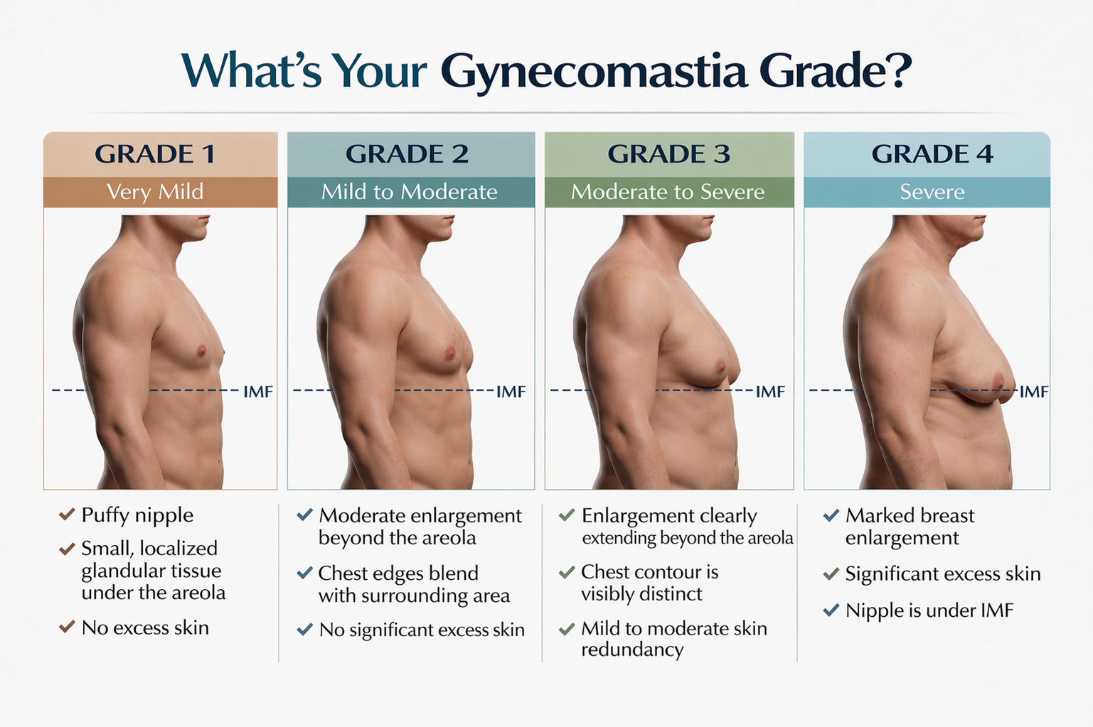 Gynecomastia Grades and Treatment